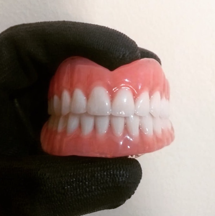 Prótese dentária de alta qualidade – Laboratório Fenix 07